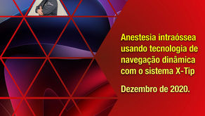 Anestesia intraóssea usando tecnologia de navegação dinâmica