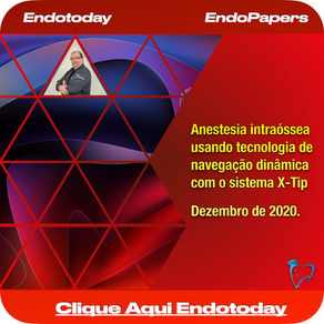 Anestesia intraóssea usando tecnologia de navegação dinâmica