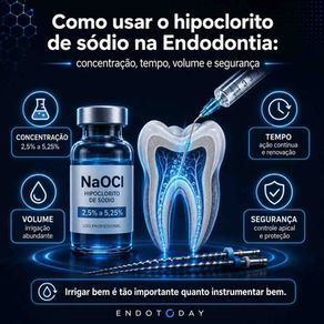 Como usar o hipoclorito de sódio na Endodontia: concentração, tempo, volume e segurança