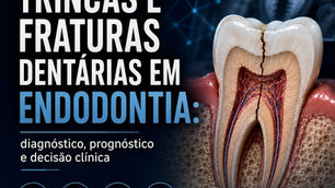 trincas e fraturas dentárias