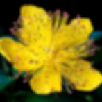 Bright yellow Aaron's Beard flower with numerous delicate stamens and red-tipped anthers, set against a dark, blurred background. Vivid and lively.
