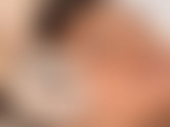 How Long Is Recovery From Dermal Fillers Injections Dubai?
