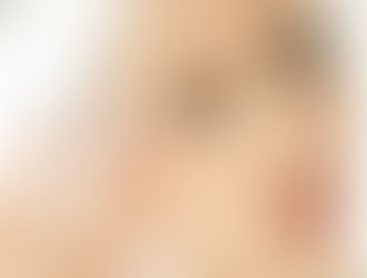 Dùng sữa rửa mặt nào tốt cho da nhạy cảm?