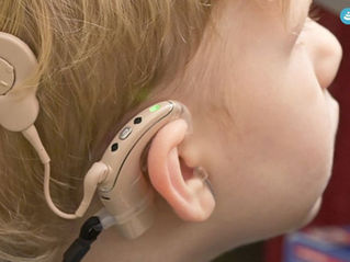 Online AVT for Cochlear Implant
