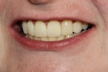 Bristol Dentist, Saltford dentist, Bath dentist