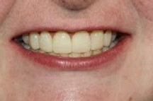 Bristol Dentist, Saltford dentist, Bath dentist