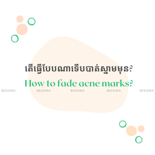 How to treat acne scars?