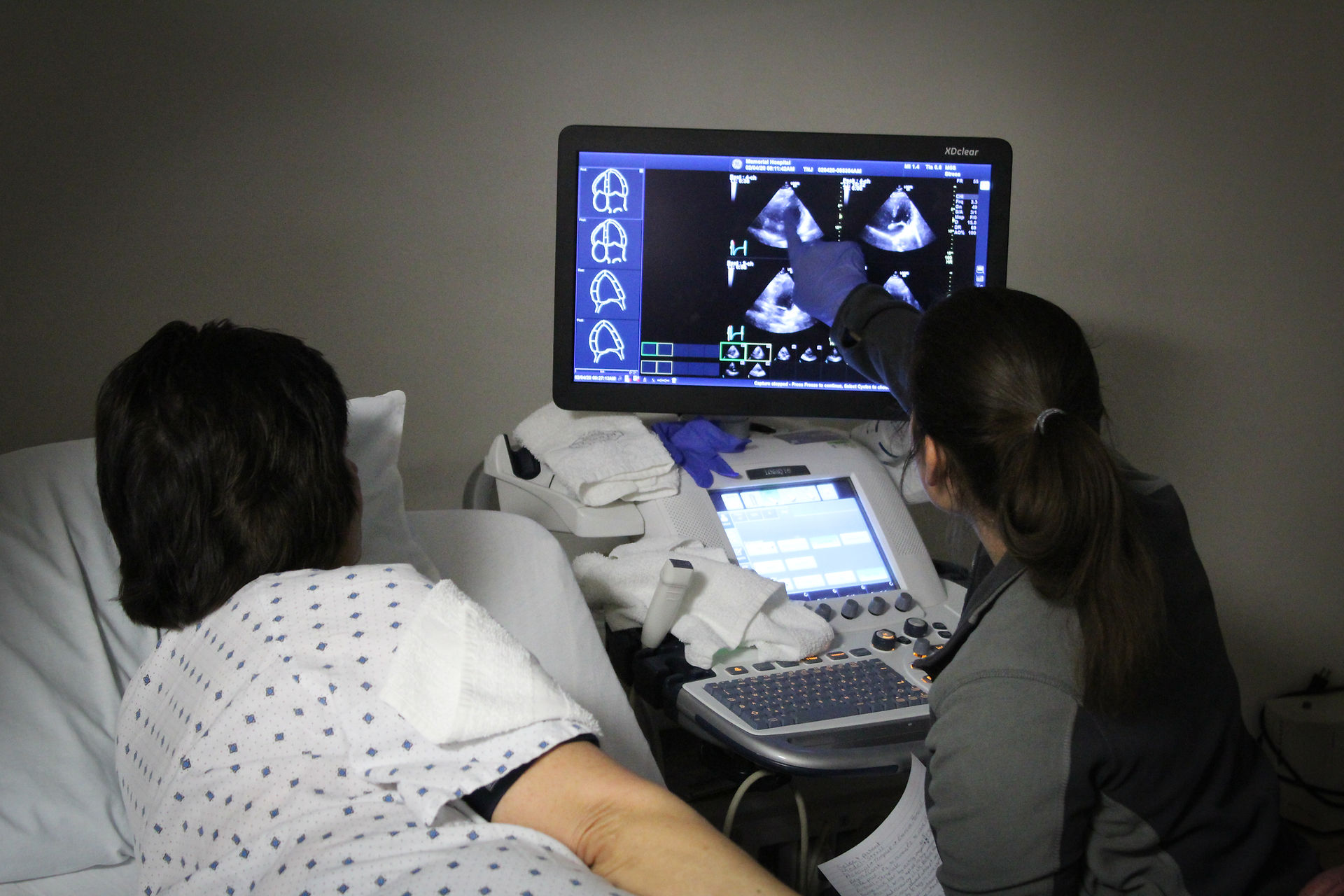 Echocardiogram