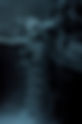 X-Ray