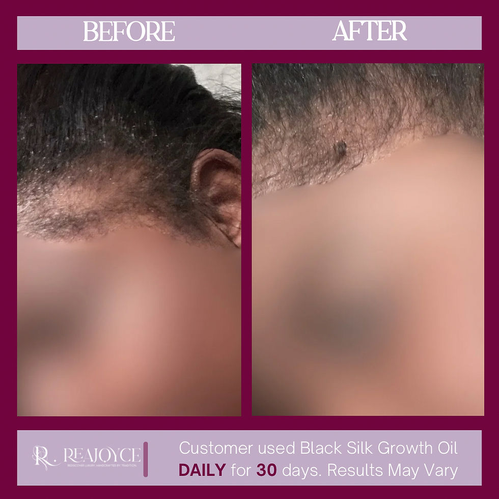Thumbnail: Black Silk Hair Growth Oil