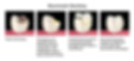 The tooth repair steps in biominmetic or conservative dentistry.