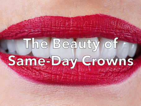10 reasons why you should come to us when you need a crown. We offer same-day crown service.