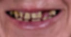Man who desperately needs a smile makeover