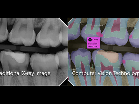 Say Hello to Pearl ... Computer Vision Technology now offered in our dental practice.