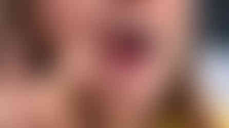 Image of a woman with one missing tooth.