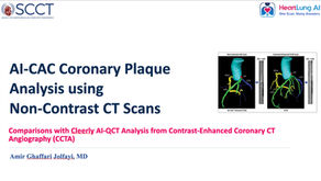AI-CAC: Coronary Plaque Analysis from Non-Contrast CT
