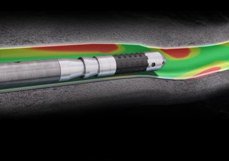 Dissolvable Frac Plugs: Enhancing Productivity While Minimizing Environmental Impact