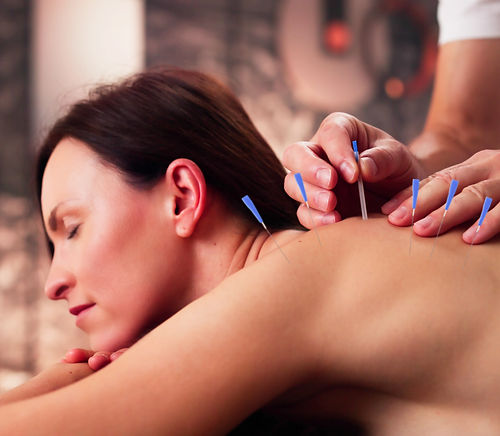 Smiling Young Woman Receiving Acupuncture Treatment In Spa.jpg