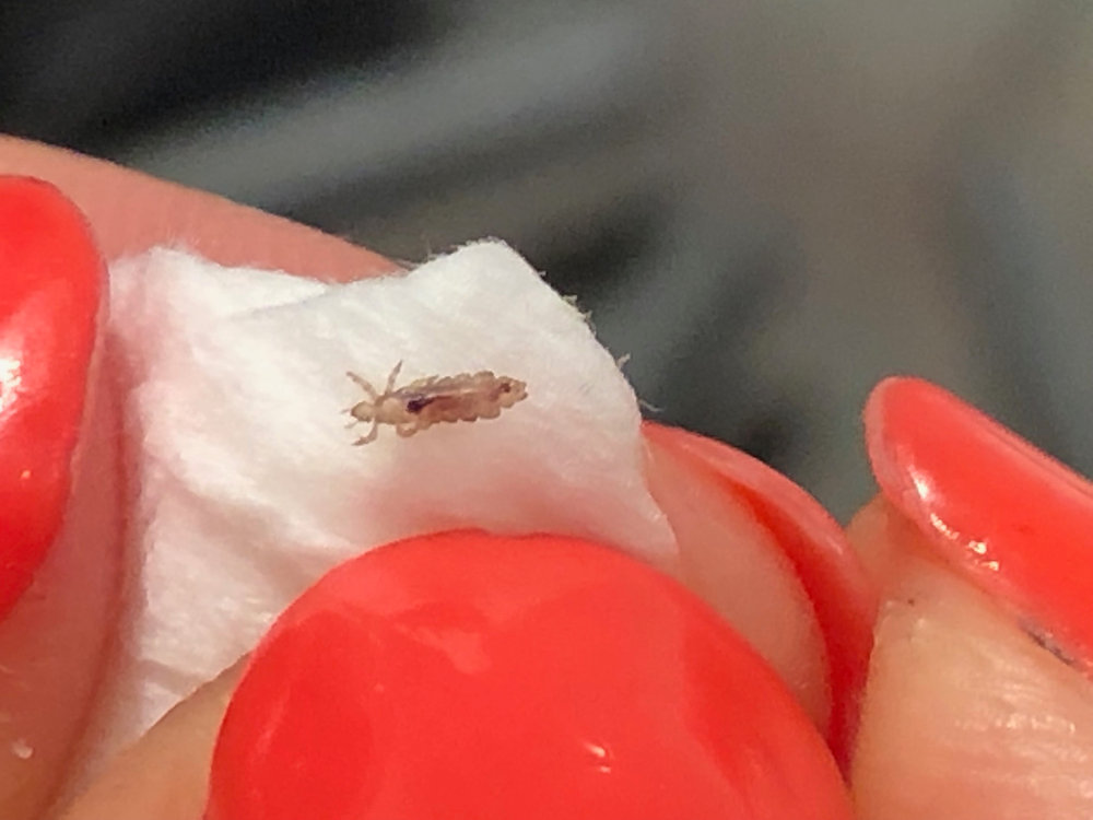 Advocating Routine Lice Combing