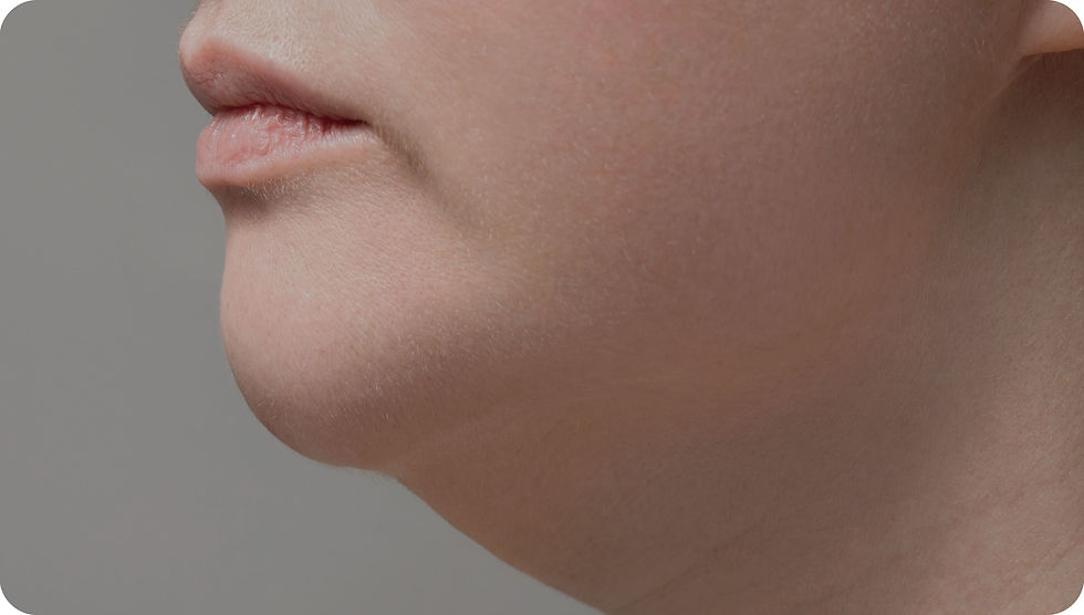 67c9e6a6a2e7388a9d523398_Profile Aesthetics Treatments Carrousel-20.jpg