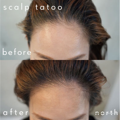 30代女性　フェイスライン