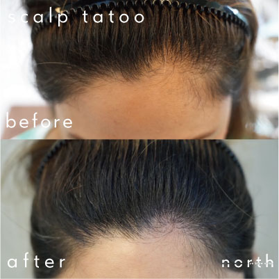 20代女性　フェイスライン