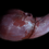 Thumbnail: 1:1 Human Liver Silicone Replica
