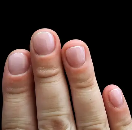 Nagelbijter resultaat.webp