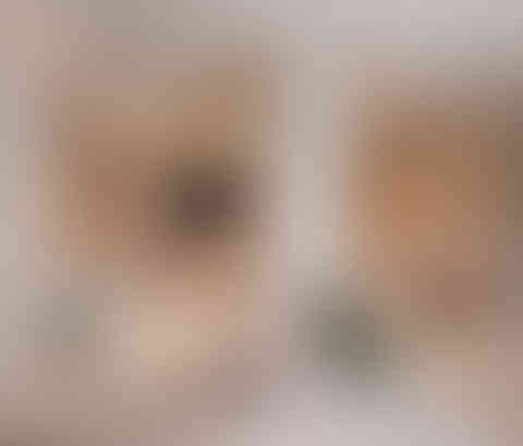 20231007_atelierparfait_Mougins_Aesthetic_Clinic114852