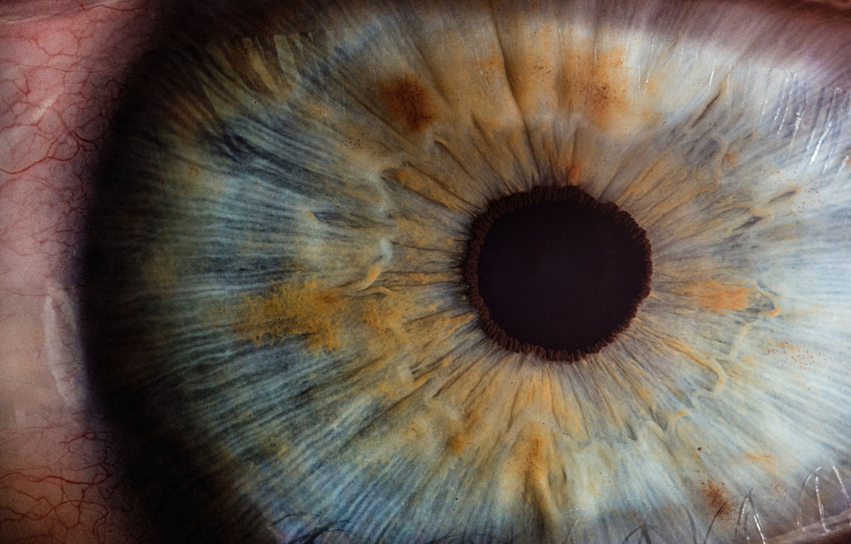 Idaho Retina Center PLLC