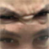 Before and after wrinkle relaxer in the glabella, AKA the "11"s or frown lines. Results are smoothed skin.