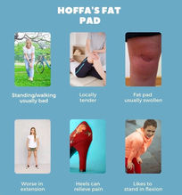 hoffa fat pad impingement /syndrome usually have pain patterns:
1) standing walking usually more painful
2) locally swollen
3) likes bending knee or positions that keep knee bend (sitting
4) likes to stand with knee in flexion
5) heels can relieve pain
6) worse in extension (standing/flat shoes/slippers)