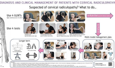 diagnosis and management of cervical radiculopathy nerve compression / pain sensitivity
patient history, phyiscal exam, and imaging are important details needed to diagnose radiculopathy.
Physical examination: 4 upperlimb neural test: median, ulnar , radial peripheral nerves; and 4 test - spurling , traction distraction, arm squeeze tests
thereafter, a targeted multimodal treatment approach can be used to manage this condition.
for acute nerve pain
1) NSAIDs, lyrica, gabapentin
2) cervical openers
3) neurodynamics gliders
4) collar brace
5) offload arm and neck
6) pain education
mid term:
1) contralateral cervical glides
2) motor control exercise
3) thoracic manipulation
4) axio-scapular strengthening
5) cervical mobilisation
6) general fitness
longer term
1) key muscle strength
2) patient specific functional rehabiliation
3) aerobic fitness
4) body strength
often the dx and mgmt of this group patient population requires co mgmt from the medical and physio team. Both together with the patient needs to set clear timeline and goals based on the needs and values of the patient.
important to know when to refer out to medical team:
1) rapid neurological deterioriation
2) cant sleep
3) cant move
4) pain that is off the scale
5) not responding to physio treatments
6) unable to resume normal activities
7) pt not making progress with conservative treatment
However, the list below highlights when physio can continue physical treatment for the patient:
1) if patients are responding to physio rx - e.g. functionally, strength is not deteriorating, getting better, decreasing pain, being able to go back to things that they are used to doing
safe to examine
2) low distress, mild sleep disturbance, mild reflex loss and strength
3) during ax - there is no rapid progression of condition
4) pt that are not making progress bcos past treatments are passive or that medications they recieve were only simple analgesias
(may get pt to go get medicine that targets the neuro system and quiet it down before manual therapy)