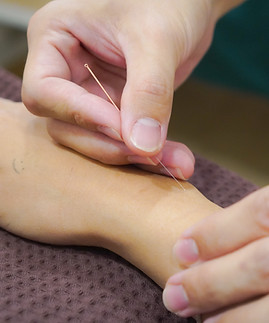 Acupuncture treatment on the back by a licensed TCM practitioner at Phangnga TCM Clinic Phuket