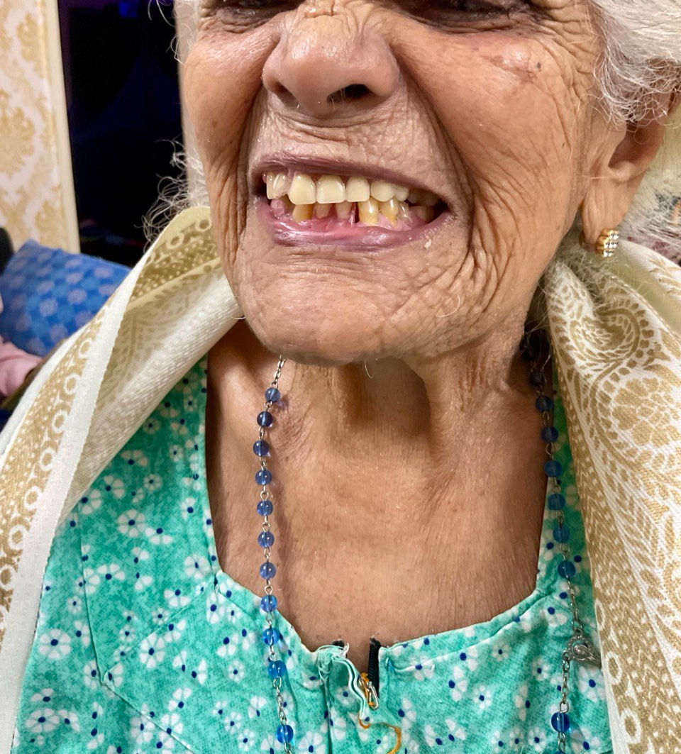 Home dental visit bangalore