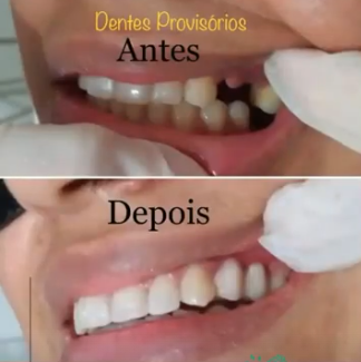 Reabilitação oral