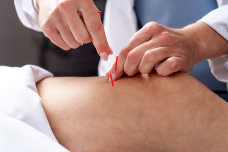 Acupuncture San Diego 066.jpg