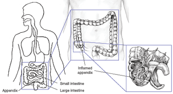 appendix.gif
