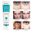 Thumbnail: iBeaLee Whitening Freckle Cream Remove Melasma Dark Spots Cream Anti-Aging 20ml