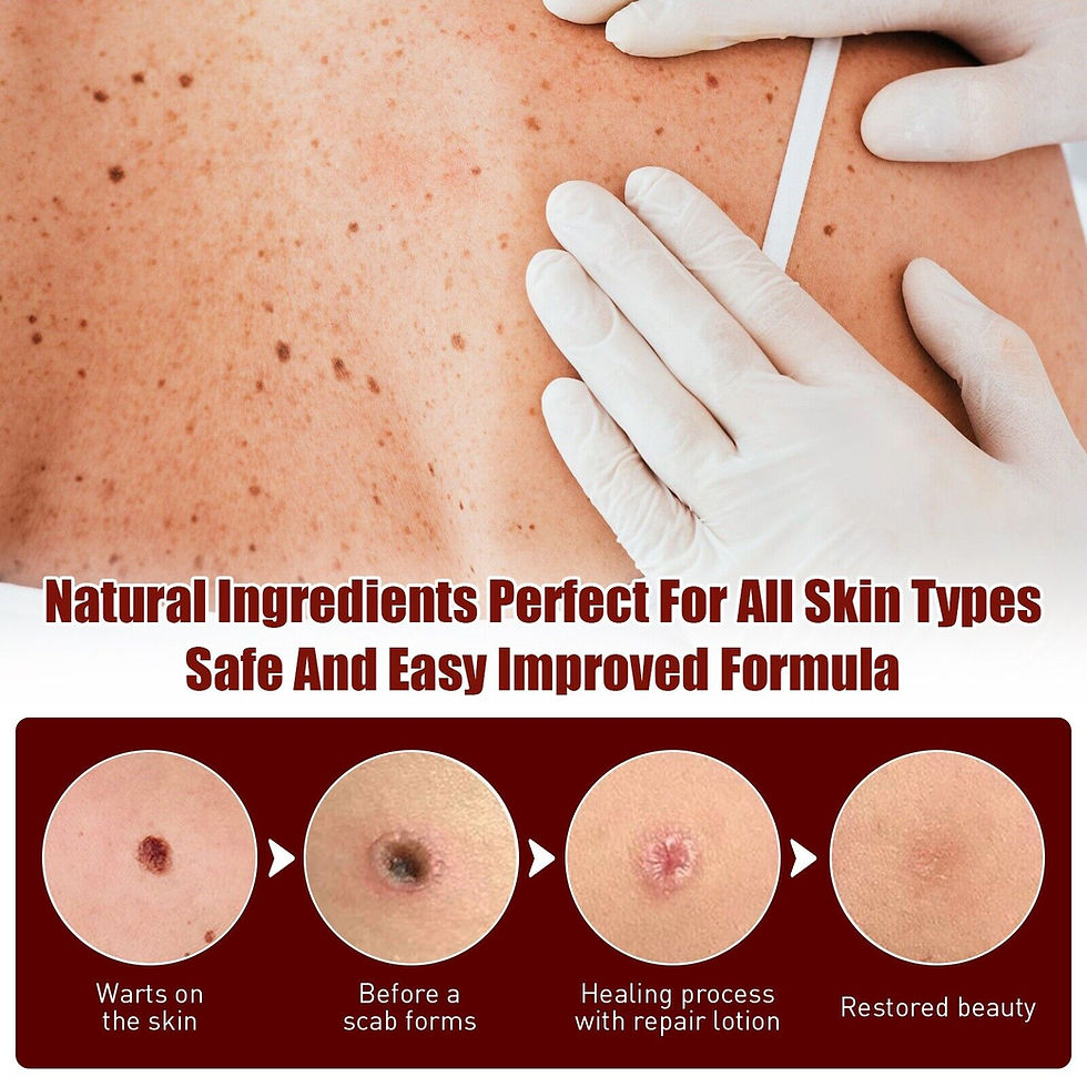 Thumbnail: 2PACK 12 Hours Wart Remover Pen Skin Tag Mole Remover Eliminate Foot Corn Warts.