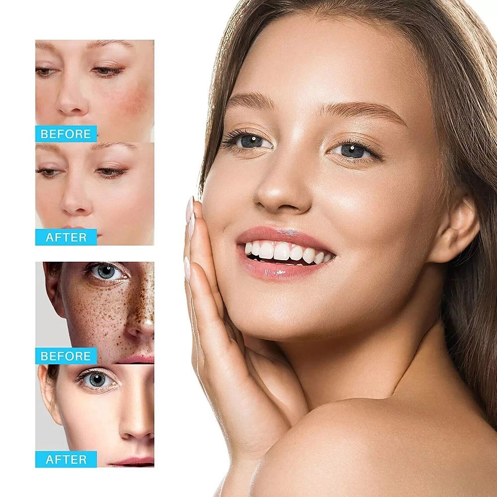 Thumbnail: iBeaLee Whitening Freckle Cream Remove Melasma Dark Spots Cream Anti-Aging 20ml