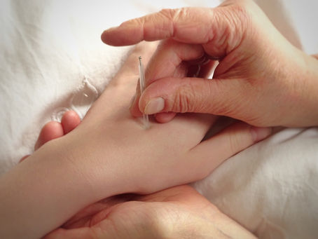 Acupuncture Services: Benefits, Risks, and How Many Sessions You Need