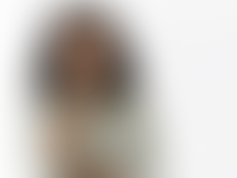 DIFERENÇA ENTRE PREENCHIMENTOS DÉRMICOS E BOTOX