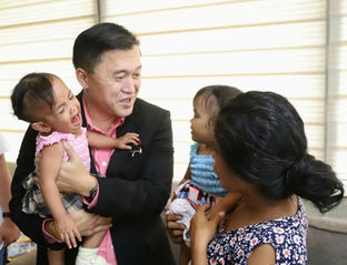 Grateful conjoined twins pay Go a visit