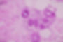 Backgrounds of human cells tissue of cervix under the microscope in pathology labView in m