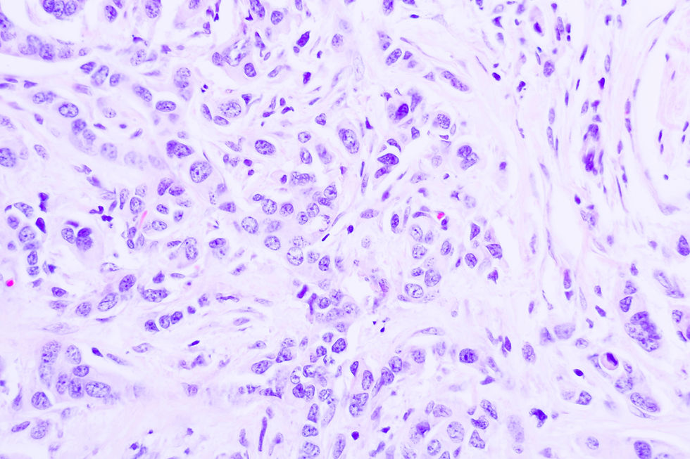Backgrounds of human cells tissue of lung human under the microscope in pathology labView
