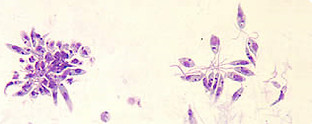 Leishmania