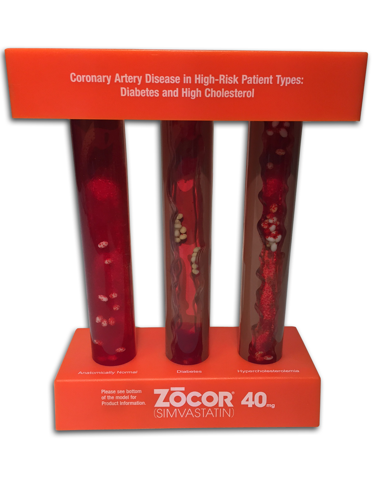 Clogged Artery Comparison Model
