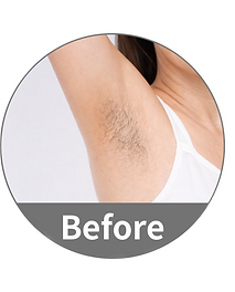 Before (1)_edited.png