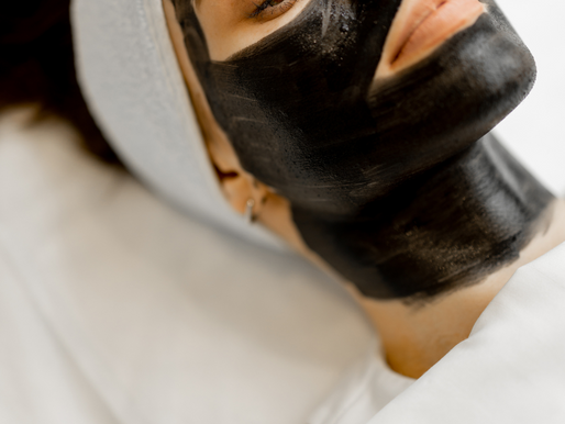 The Benefits of Carbon Laser Peel for Acne-Prone Skin